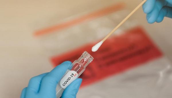 Ghidurile de utilizare a testelor rapide